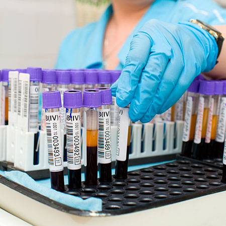 Анализы перед планированием беременности